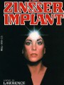 1979   the zinsser implant by lawrence kamark dell